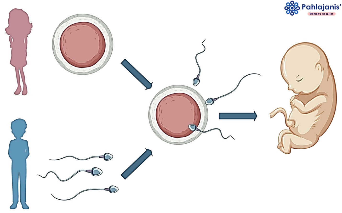 Understanding the IVF Process: Best IVF Center in Bilaspur