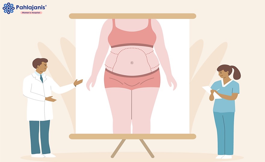 How Total Abdominal Hysterectomy Impacts Your Hormones and Mood